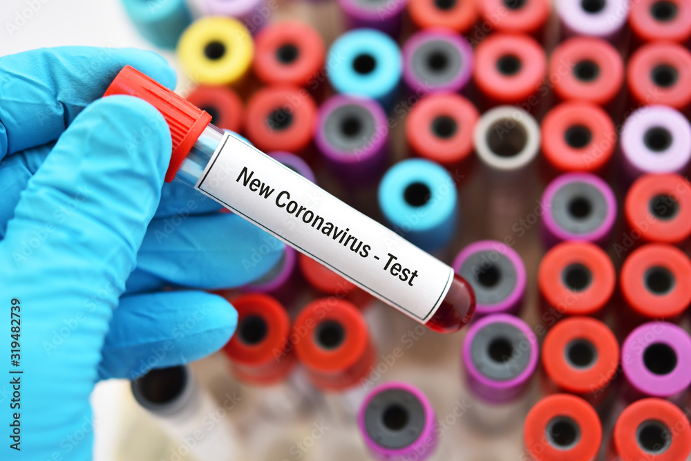 Obraz premium Blood sample tube for new coronavirus test, novel coronavirus 2019 found in Wuhan, China