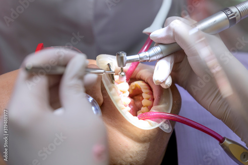 Dentist making professional teeth cleaning man young photo