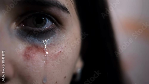 Close-up of the eye of a young female victim of domestic violence. A tear runs down. Signs of a beating.