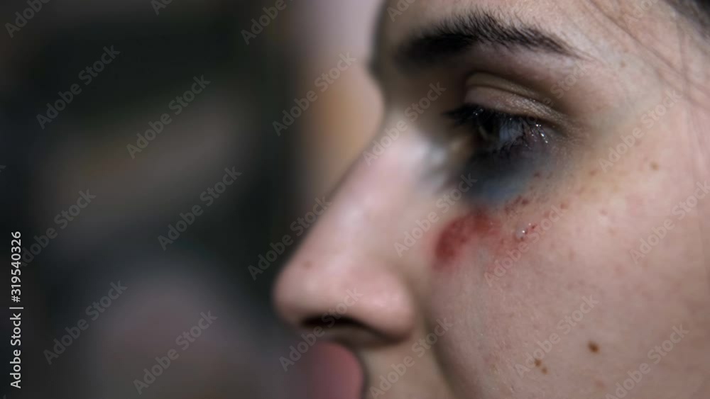 Close-up of a tear on the face of a young woman with a trauma from violence. Close-up of a tear on the face of a young woman with a trauma from violence.