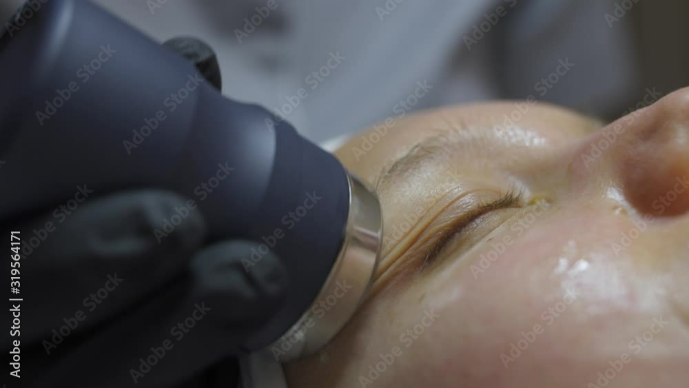the cosmetologist passes the device in the form of a barrel, over the face oiled on the face, of a girl