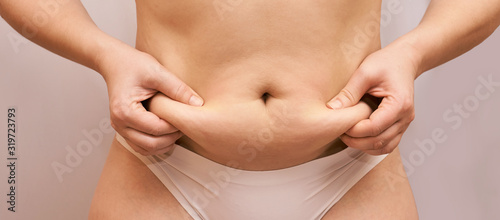 Fat unhealthy woman body. Pinch belly side. Measurement lady procedure. Medicine pinching. Anti cellulite overweight