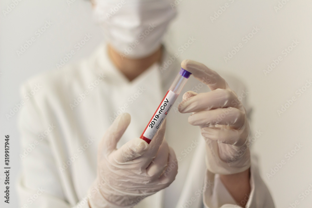 Doctor or nurse with gloves and respiratory face mask holding a positive blood test for Coronavirus 2019-nCoV Doctor or nurse with gloves and respiratory face mask holding a positive blood test for Coronavirus 2019-nCoV