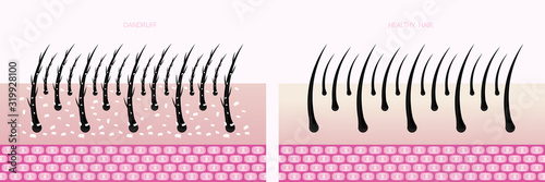 Hair problem and hair protect and care technology concept vector illustration.