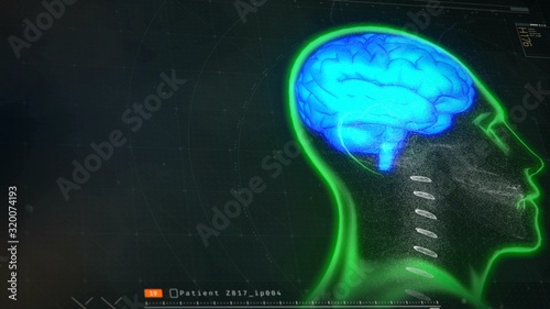 Medical software monitoring patient's brain activity, MRI test results on screen