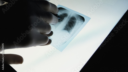 Doctor checking on chest X-ray. Man holding radiography looking at it.