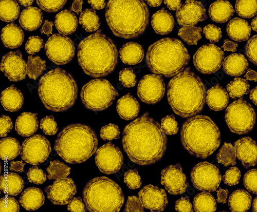 detail of ultraestructure of deadly coronavirus particles under transmission electron microscopy (TEM) photo