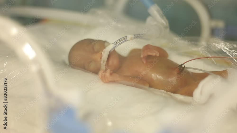 Premature Baby in the Tub