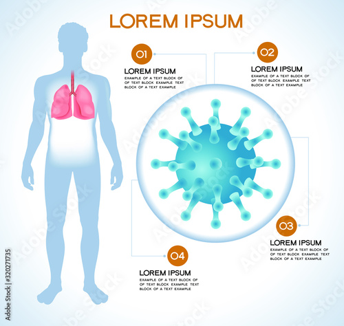 Virus. Modern medical infographics. Coronaviruses in a human body. Anatomy of people