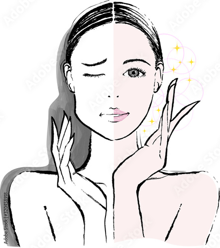 女性　エラ張り　ビフォーアフター