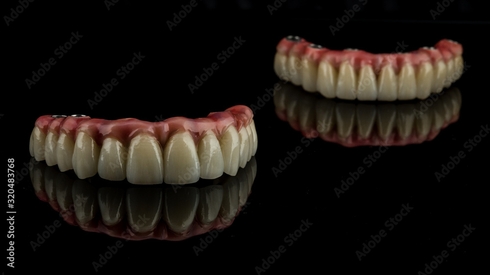dental implants on a black background dental implants on a black background