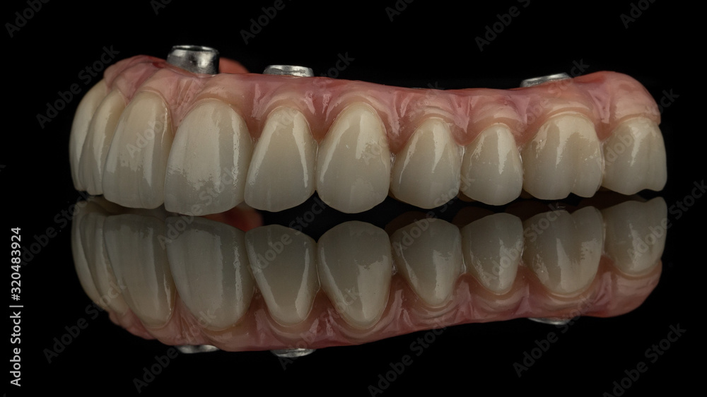 dental implants on a black background dental implants on a black background