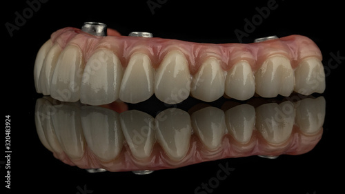 dental implants on a black background