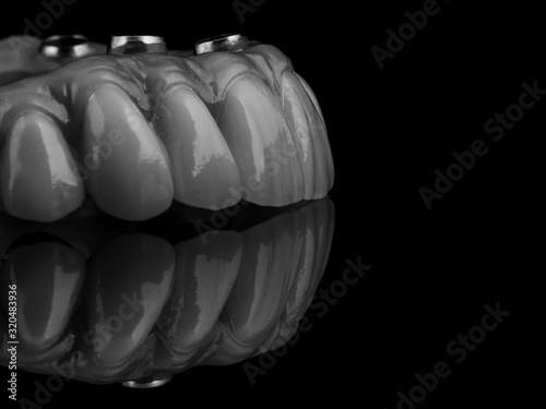 dental implants on a black background