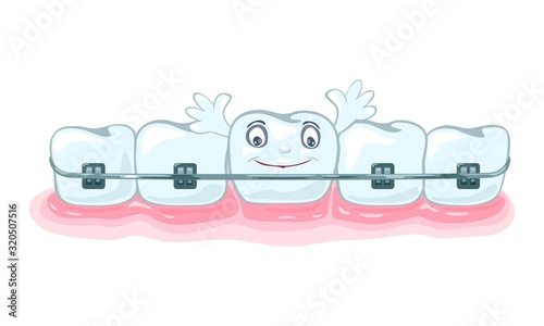 Using of metallic dental braces, orthodontic brackets to correct occlusion, alignment of dentition. Happy healthy beautiful teeth are in gum. Vector cartoon illustration isolated on white background.