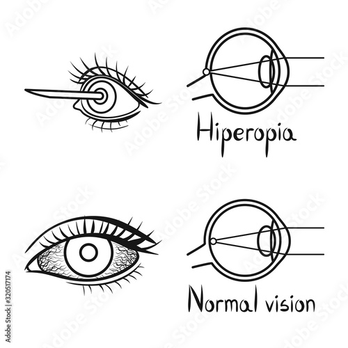 Isolated object of correction and optometry sign. Set of correction and vision stock symbol for web.