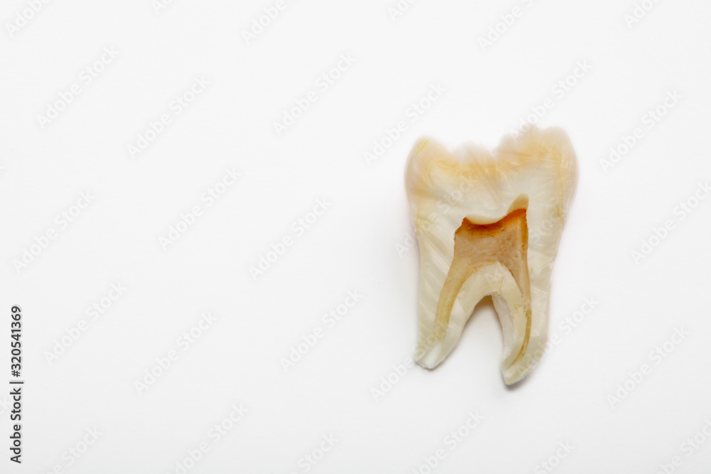 Toothache, human tooth close-up on a red background Toothache, human tooth close-up on a red background