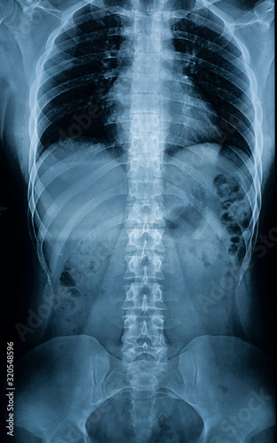 X-ray of a man’s body - spine, pelvic bones, ribs, internal organs