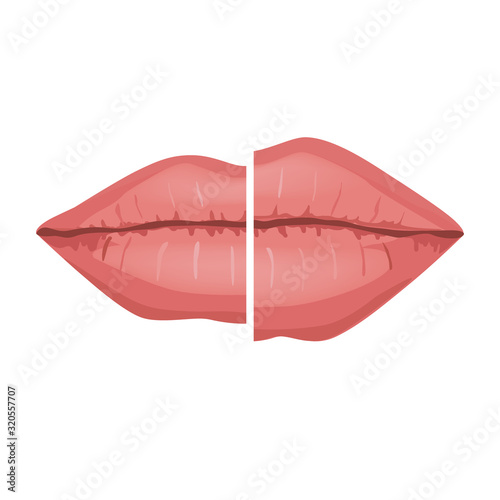 Female Lips Before and after Filler Injections, Vector Infographic illustration. Beautiful and Sexy Perfect Lips Isolated on White background