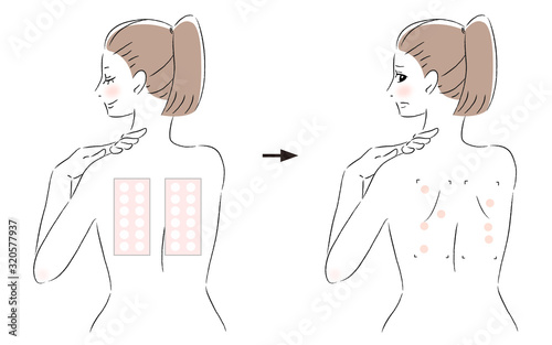 パッチテスト　スティンギングテスト　女性　検査後　比較