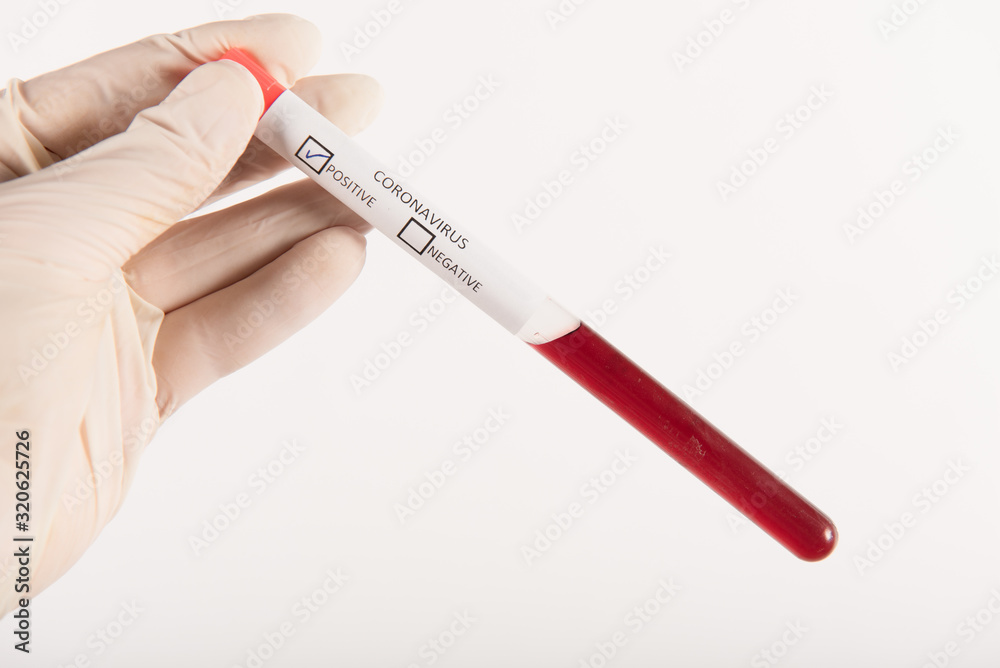 Naklejka premium Illustration of hand with gloves holding test-tube with corona virus ncov blood.
