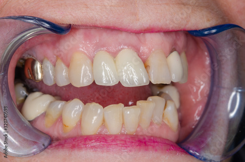 situationsfoto vor der behandlung beim zahnarzt