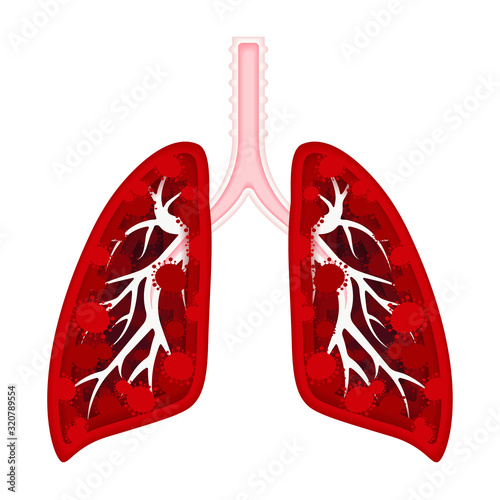 Virus-infected lungs. Pneumonia, influenza, colds, viral infections. Coronavirus (2019-nCoV). Paper style illustration. Stock vector illustration on a white background