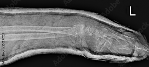 X-ray of the profile view of the left arm and of the hand in a cast after a fracture photo
