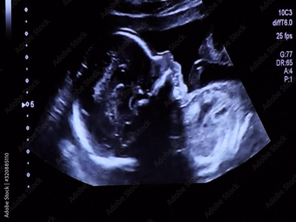 Vídeo do Stock Cute 20 weeks baby fetus face profile during ultrasound