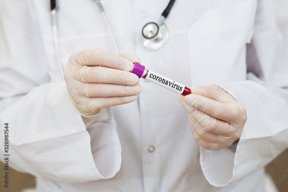 a female doctor in a white coat, with a phonendoscope around her neck and gloves, holds a positive blood test for coronavirus. test tube with virus analysis a female doctor in a white coat, with a phonendoscope around her neck and gloves, holds a positive blood test for coronavirus. test tube with virus analysis
