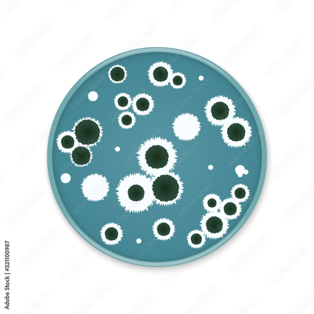 Bacteria colony spots on round dishes Bacteria colony spots on round dishes