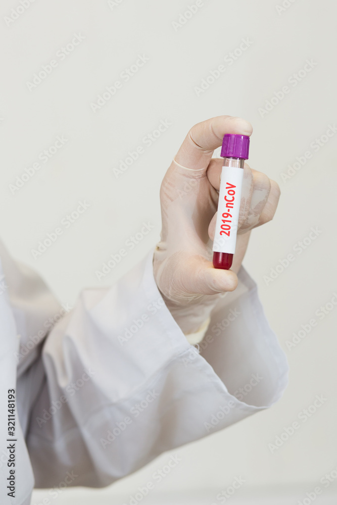 a doctor in a white coat, with a phonendoscope around her neck and gloves, holds a positive blood test for coronavirus. test tube with virus analysis a doctor in a white coat, with a phonendoscope around her neck and gloves, holds a positive blood test for coronavirus. test tube with virus analysis