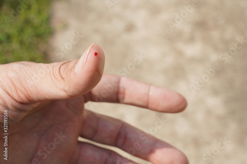 A person with a drop of blood on their thumb from a cat attack © Hip.hub