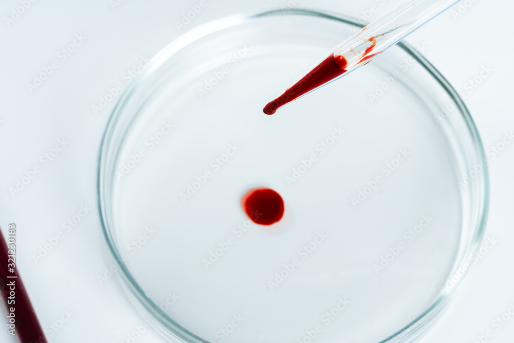 Glass dropper and Petri dish on laboratory table Glass dropper and Petri dish on laboratory table