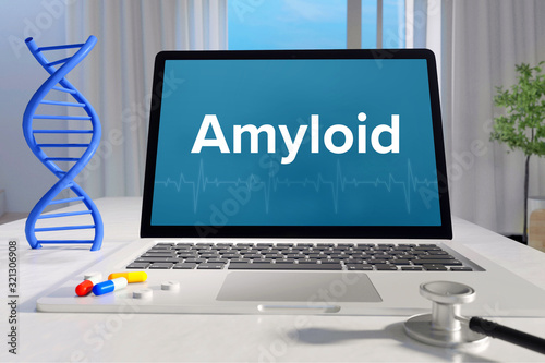 Amyloid – Medizin/Gesundheit. Computer im Büro mit Begriff auf dem Bildschirm. Arzt/Gesundheitswesen