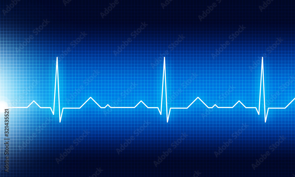 Ecg graph medical background. 3d illustration. Ecg graph medical background. 3d illustration.