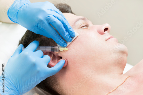The man underwent a course of mesotherapy in the clinic to improve the condition of the skin of the face.