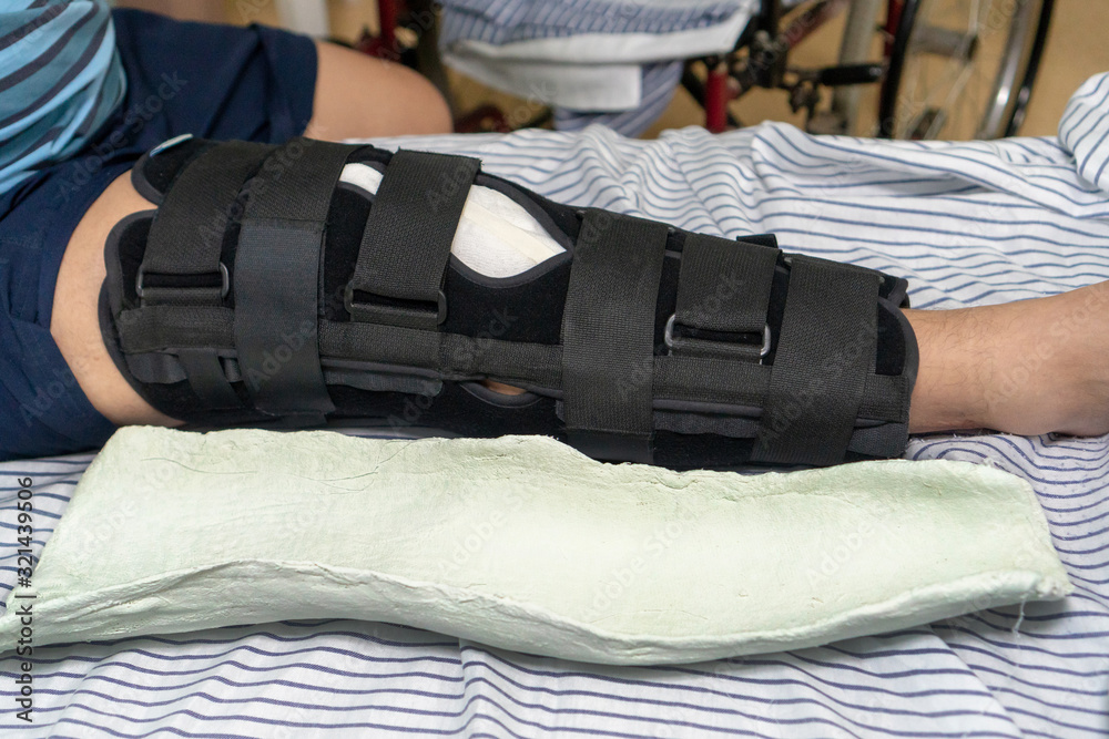 A man lies on a hospital bed in an orthopedic splint on the knee joint.  Nearby