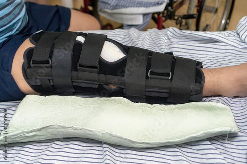 A man lies on a hospital bed in an orthopedic splint on the knee joint. Nearby lies gypsum, which was removed from his leg. Trauma of knee in brace. Knee joint retainer. An alternative to plaster on