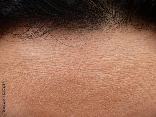 Tablou pe pânză skin of forehead texture