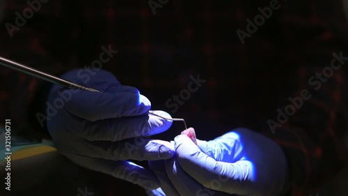 Students of dentists learn to fill the root canals of artificial teeth. Stmatlog picks a tooth with a tool.