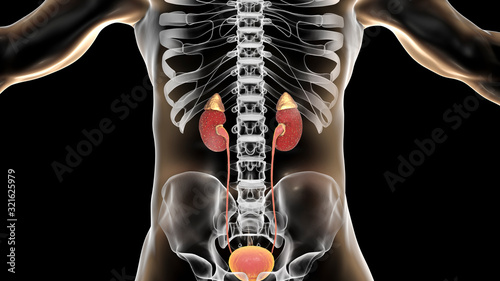 Acute pyelonephritis, medical concept photo