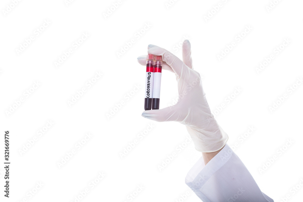 Close-up of hands with a clean test tube and a blood tube of a new coronavirus. Epidemic of the disease Close-up of hands with a clean test tube and a blood tube of a new coronavirus. Epidemic of the disease