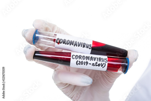 Close-up of a hand containing two blood samples in which the coronavirus was detected