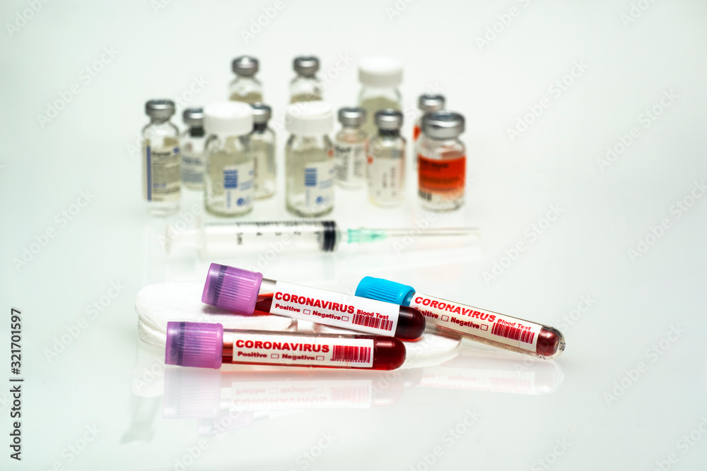 Coronavirus blood test . 2019-nCoV Coronavirus originating in Wuhan, China Coronavirus blood test . 2019-nCoV Coronavirus originating in Wuhan, China