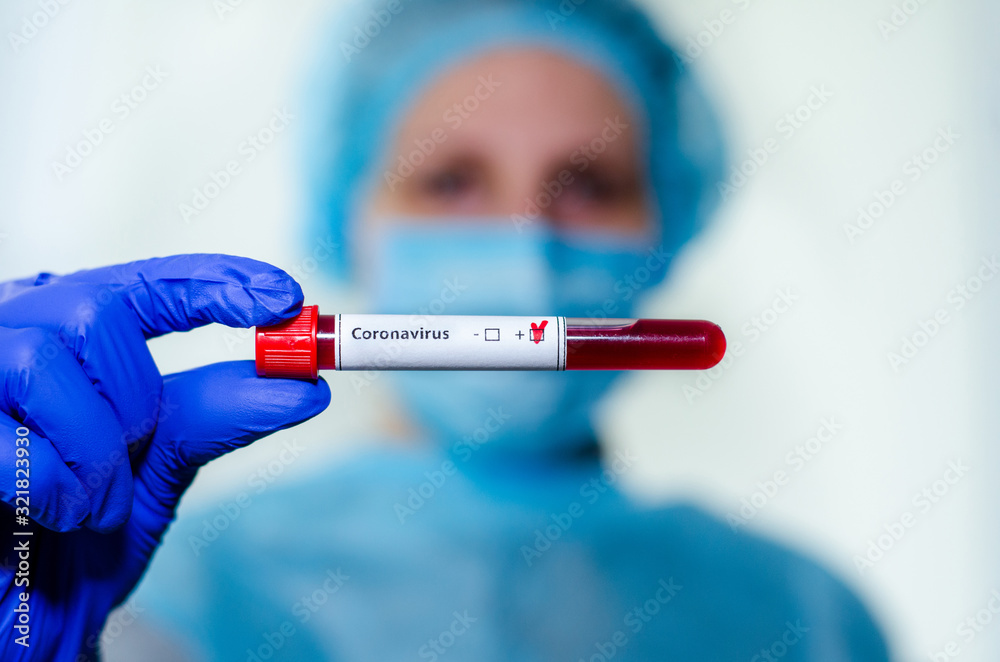 Medical laboratory assistant holding test tube with positive Coronavirus test blood sample. Medical laboratory assistant holding test tube with positive Coronavirus test blood sample.