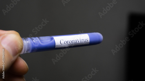 coronavirus test, search for an epidemic vaccine