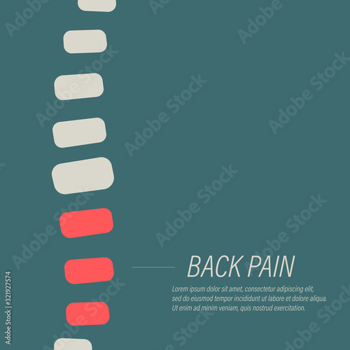 Lower back pain flat illustration.	