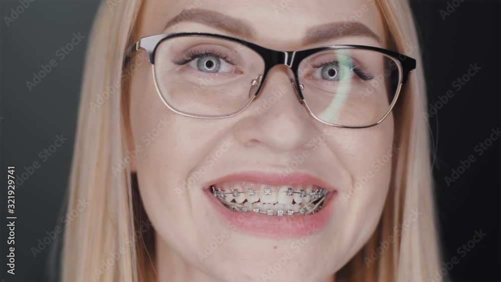 Attractive blonde hair business woman in glasses is looking at camera and smiles to show teeth braces standing at black background. Orthodontic treatment concept. Slowmotion closeup portrait 4K video