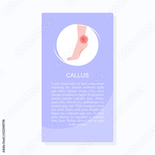 Concept of foot callus. Pain markers on foot.